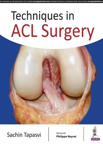 Techniques in ACL Surgery cover