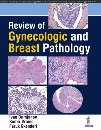 Review of Gynecologic and Breast Pathology cover