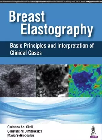 Breast Elastography cover