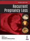Recurrent Pregnancy Loss cover