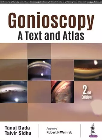 Gonioscopy: A Text and Atlas cover