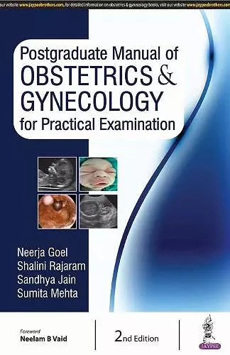 Postgraduate Manual of Obstetrics & Gynecology for Practical Examination cover