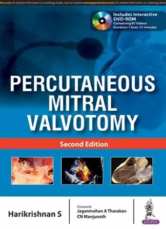 Percutaneous Mitral Valvotomy cover