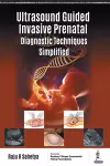 Ultrasound Guided Invasive Prenatal Diagnostic Techniques Simplified cover