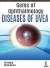 Gems of Ophthalmology: Diseases of Uvea cover