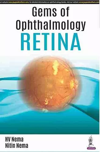 Gems of Ophthalmology: Retina cover