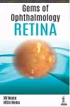 Gems of Ophthalmology: Retina cover