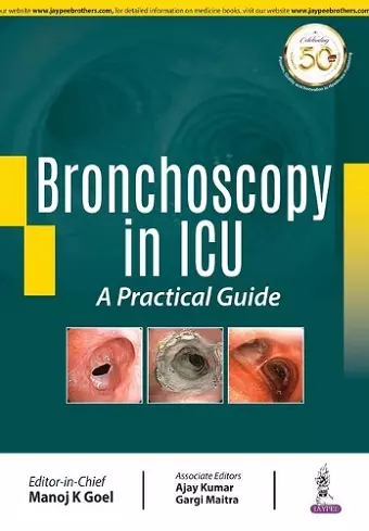 Bronchoscopy in ICU: A Practical Guide cover