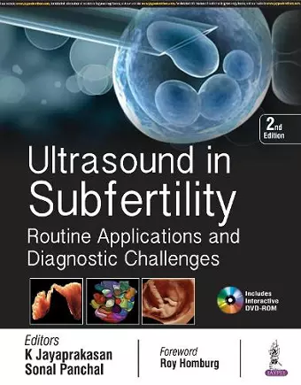 Ultrasound in Subfertility cover