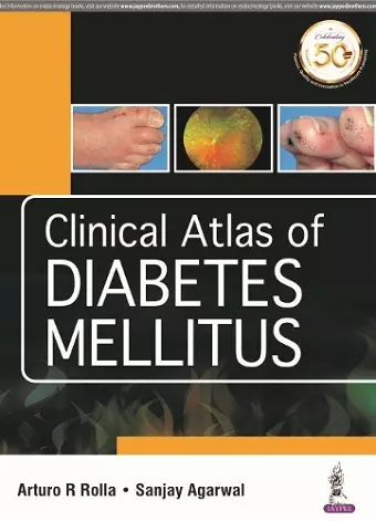 Clinical Atlas of Diabetes Mellitus cover