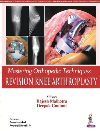 Mastering Orthopedic Techniques: Revision Knee Arthroplasty cover