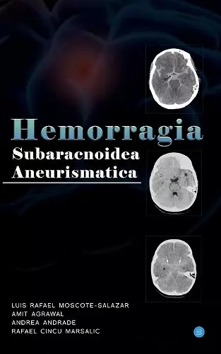 Hemorragia Subaracnoidea Aneurismatica cover