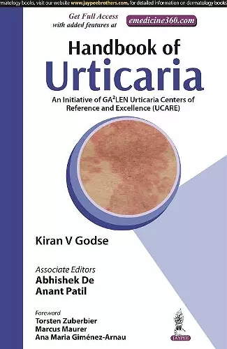 Handbook of Urticaria cover