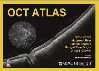 OCT Atlas cover