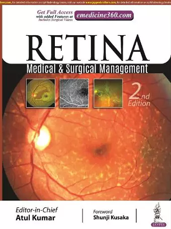 Retina cover