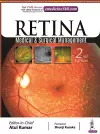Retina cover