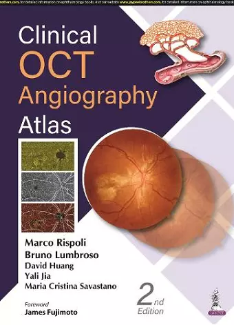 Clinical OCT Angiography Atlas cover