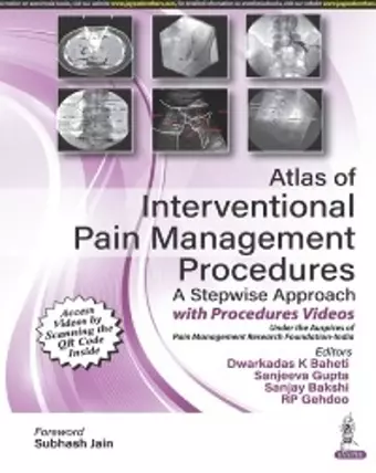 Atlas of Interventional Pain Management Procedures cover