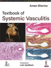 Textbook of Systemic Vasculitis cover