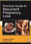 Practical Guide to Recurrent Pregnancy Loss cover