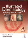 Illustrated Dermatology cover