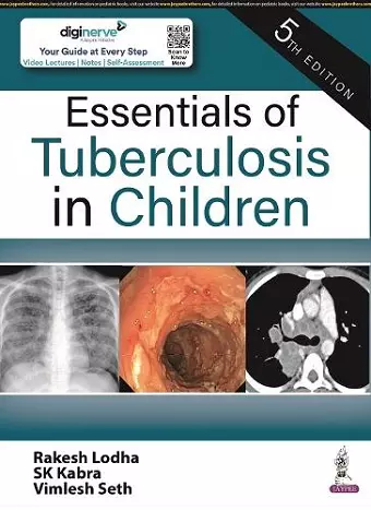 Essentials of Tuberculosis in Children cover