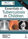 Essentials of Tuberculosis in Children cover