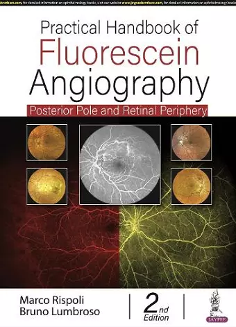 Practical Handbook of Fluorescein Angiography cover