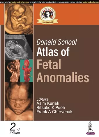 Donald School Atlas of Fetal Anomalies cover