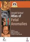 Donald School Atlas of Fetal Anomalies cover