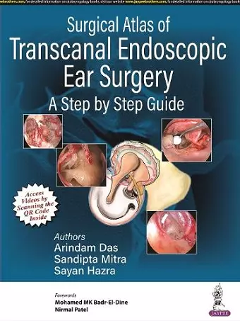 Surgical Atlas of Transcanal Endoscopic Ear Surgery cover