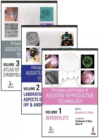 Principles and Practice of Assisted Reproductive Technology cover