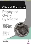 Clinical Focus on Polycystic Ovary Syndrome cover