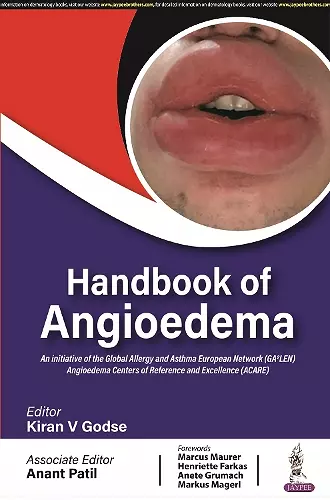 Handbook of Angioedema cover