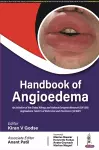 Handbook of Angioedema cover