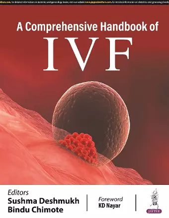 A Comprehensive Handbook of IVF cover