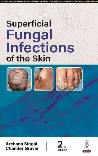 Superficial Fungal Infections of the Skin cover