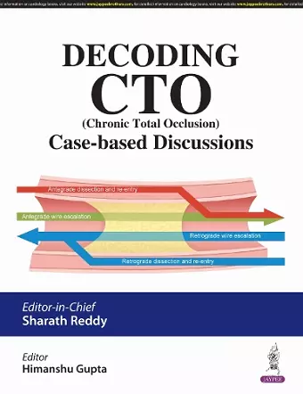Decoding CTO (Chronic Total Occlusion) cover