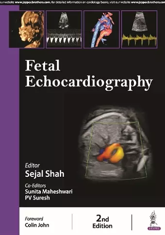 Fetal Echocardiography cover