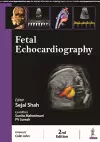 Fetal Echocardiography cover