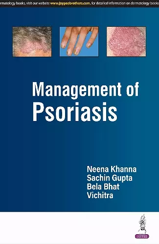 Management of Psoriasis cover