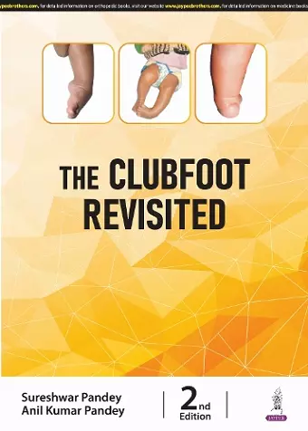 The Clubfoot Revisited cover