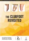 The Clubfoot Revisited cover