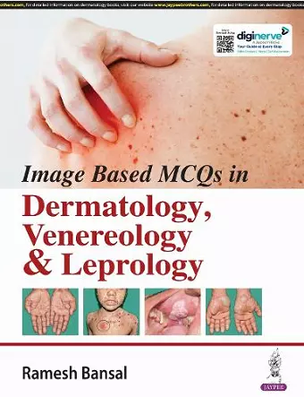 Image Based MCQs in Dermatology, Venereology & Leprology cover