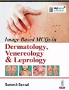 Image Based MCQs in Dermatology, Venereology & Leprology cover