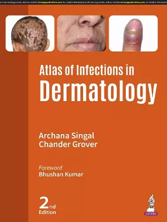 Atlas of Infections in Dermatology cover