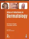 Atlas of Infections in Dermatology cover