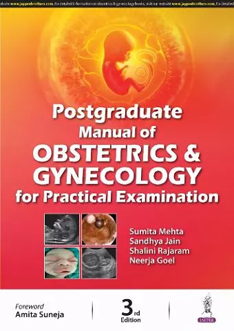 Postgraduate Manual of Obstetrics and Gynecology for Practical Examination cover