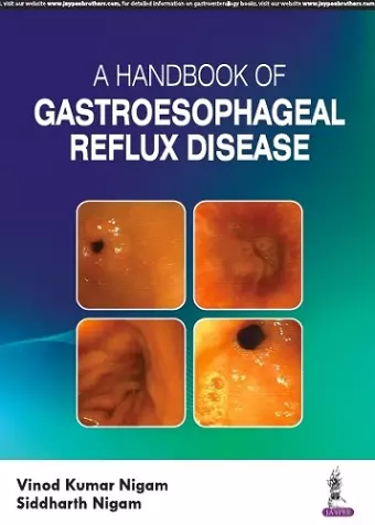 A Handbook of Gastroesophageal Reflux Disease (GERD) cover