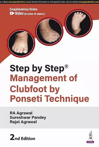 Step by Step: Management of Clubfoot by Ponseti Technique cover